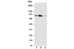 Western blot testing of APLP2 antibody and Lane 1:  rat brain (APLP2 抗体  (C-Term))