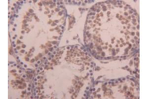 DAB staining on IHC-P; Samples: Mouse Testis Tissue (ACVR1 抗体  (AA 208-340))