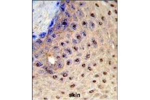 Formalin-fixed and raffin-embedded human skin reacted with X3 Antibody (N-term), which was peroxidase-conjugated to the secondary antibody, followed by DAB staining.