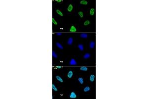 Histone H3 acetyl Lys27 mAb tested by immunofluorescence. (Histone 3 抗体  (H3K27ac))