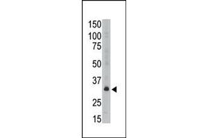 Image no. 1 for anti-Melanoma Antigen Family A, 6 (MAGEA6) (C-Term) antibody (ABIN358649) (MAGEA6 抗体  (C-Term))