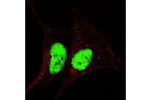Fluorescent confocal image of SY5Y cells stained with phospho-Sox2-  antibody. (SOX2 抗体  (pSer246))