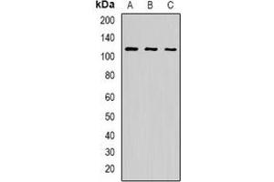 Western blot analysis of p115 expression in BT474 (A), K562 (B), A549 (C) whole cell lysates. (ARHGAP4 抗体)