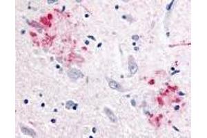 Immunohistochemistry of APP in human brain (Alzheimer’s disease) tissue with APP antibody at 10 μg/ml. (APP 抗体)