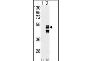 Western blot analysis of M1F (arrow) using M1F Antibody (N-term) (ABIN392883 and ABIN2842287). (PPM1F 抗体  (N-Term))
