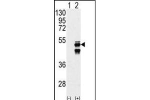 Western blot analysis of M1F (arrow) using M1F Antibody (N-term) (ABIN392883 and ABIN2842287).