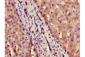Immunohistochemistry of paraffin-embedded human liver tissue using ABIN7156716 at dilution of 1:100 (ILF2 抗体  (AA 1-390))