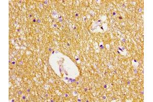 Immunohistochemistry of paraffin-embedded human brain tissue using ABIN7150072 at dilution of 1:100 (DLG2 抗体  (AA 310-420))