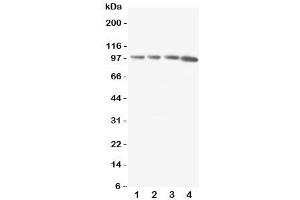 Western blot testing of RIAM antibody and Lane 1:  rat thymus (Amyloid beta (A4) Precursor Protein-Binding, Family B, Member 1 Interacting Protein (APBB1IP) (C-Term) 抗体)