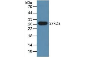 Detection of PGLYRP1 in Human Urine using Polyclonal Antibody to Peptidoglycan Recognition Protein 1 (PGLYRP1) (PGLYRP1 抗体  (AA 18-183))