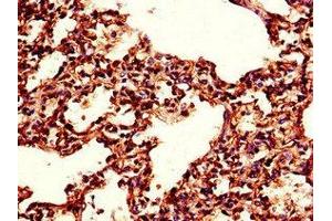 Immunohistochemistry of paraffin-embedded human lung tissue using ABIN7173415 at dilution of 1:100 (TPI1 抗体  (AA 169-228))