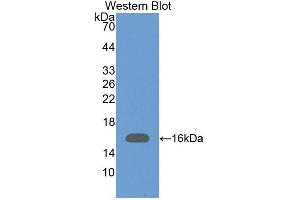 Western blot analysis of the recombinant protein. (VPREB1 抗体  (AA 33-135))