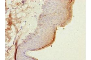 Immunohistochemistry of paraffin-embedded human skin tissue using ABIN7147374 at dilution of 1:100 (CEP57L1 抗体  (AA 1-167))