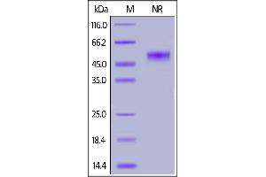 SDS-PAGE (SDS) image for CD40 Ligand (CD40LG) (AA 116-261) (Active) protein (DYKDDDDK Tag,His tag) (ABIN6952262)