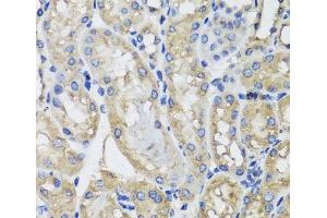 Immunohistochemistry of paraffin-embedded Mouse kidney using MRPS22 Polyclonal Antibody at dilution of 1:100 (40x lens).