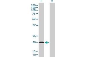 Western Blot analysis of UXT expression in transfected 293T cell line by UXT MaxPab polyclonal antibody. (UXT 抗体  (AA 1-169))