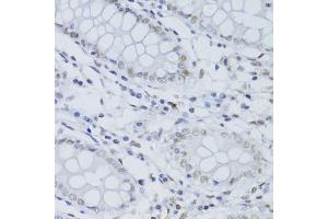 Immunohistochemistry of paraffin-embedded human colon using SNRNP70 antibody (ABIN5973598) at dilution of 1/100 (40x lens). (SNRNP70 抗体)
