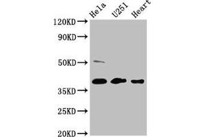 Western Blot Positive WB detected in: Hela whole cell lysate, U251 whole cell lysate, Mouse heart tissue All lanes: RCN3 antibody at 4. (RCN3 抗体  (AA 71-161))