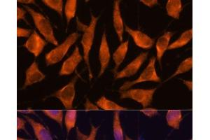 Immunofluorescence analysis of L929 cells using LHPP Polyclonal Antibody at dilution of 1:100. (LHPP 抗体)