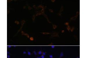Immunofluorescence analysis of NIH/3T3 cells using UBE2L6 Polyclonal Antibody at dilution of 1:100. (UBE2L6 抗体)