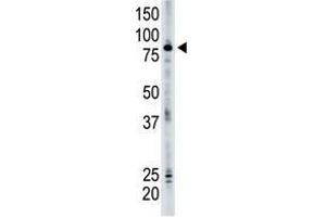 Image no. 1 for anti-SMAD Specific E3 Ubiquitin Protein Ligase 2 (SMURF2) (N-Term) antibody (ABIN357471) (SMURF2 抗体  (N-Term))