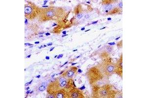 Immunohistochemical analysis of UBE2J2 staining in rat liver  formalin fixed paraffin embedded tissue section. (UBE2J2 抗体)