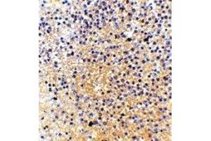 Immunohistochemistry (IHC) image for anti-Lymphocyte Antigen 86 (LY86) (Middle Region) antibody (ABIN1030998) (LY86 抗体  (Middle Region))