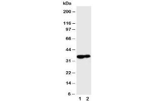 Western blot testing of Kallikrein 9 antibody and Lane 1:  MCF-7 (Kallikrein 9 抗体  (C-Term))