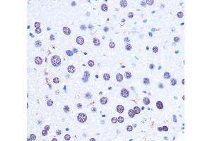 Immunohistochemistry of paraffin-embedded Mouse liver using CHD4 Polyclonal Antibody at dilution of 1:100 (40x lens). (CHD4 抗体)