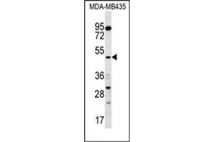 Western blot analysis of SNX4 Antibody (C-term) in MDA-MB435 cell line lysates (35ug/lane). (Sorting Nexin 4 抗体  (C-Term))