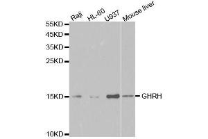Western blot analysis of extracts of various cell lines, using GHRH antibody. (GHRH 抗体  (AA 21-107))