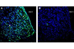 Expression of CD81 in rat medial habenula. (CD81 抗体  (Extracellular))