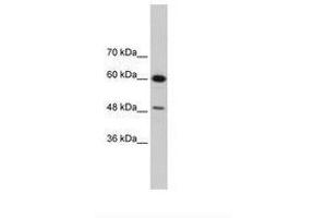Image no. 3 for anti-DAZ Associated Protein 1 (DAZAP1) (AA 321-370) antibody (ABIN202449) (DAZAP1 抗体  (AA 321-370))