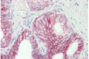 Human Prostate: Formalin-Fixed, Paraffin-Embedded (FFPE)