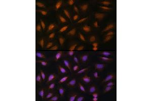 Immunofluorescence analysis of U-2 OS cells using FGF2 Rabbit pAb (ABIN3020744, ABIN3020745, ABIN3020746 and ABIN6213702) at dilution of 1:100 (40x lens). (FGF2 抗体  (AA 143-288))