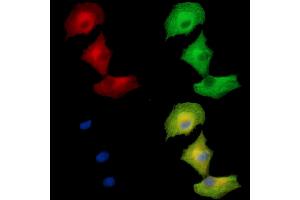 ABIN7096868 and ABIN7100934 staining  cells by IF/ICC.