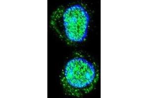 Immunofluorescence (IF) image for anti-Homeobox A10 (HOXA10) antibody (ABIN2995594) (HOXA10 抗体)