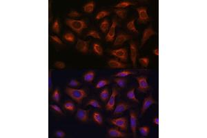 Immunofluorescence analysis of U-2 OS cells using  antibody (ABIN7265486) at dilution of 1:100. (arfgap2 抗体  (AA 242-521))