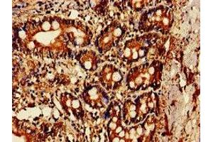 Immunohistochemistry of paraffin-embedded human small intestine tissue using ABIN7142170 at dilution of 1:100 (OAS1 抗体  (AA 296-395))
