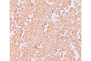 Immunohistochemical staining of human spleen cells with ZBTB8 polyclonal antibody  at 2. (ZBTB8A 抗体  (C-Term))