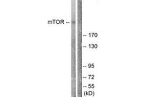 Western blot analysis of extracts from NIH-3T3 cells, treated with Insulin 0. (MTOR 抗体  (AA 2412-2461))