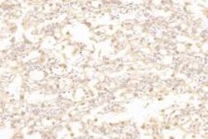 Immunohistochemistry analysis of paraffin-embedded rat placenta using,Slc6a6 (ABIN7075842) at dilution of 1: 1000 (TAUT 抗体)