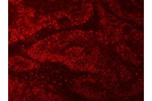 IF analysis of RNGTT using anti-RNGTT antibody (ABIN7599723).