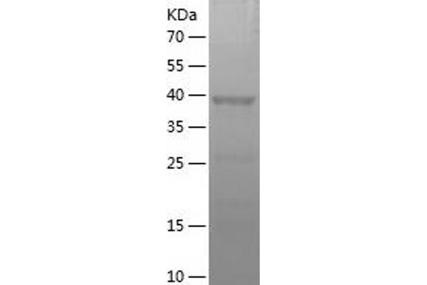 MAT1A Protein (AA 215-395) (His-IF2DI Tag)