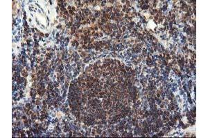 Image no. 5 for anti-Leucine Carboxyl Methyltransferase 1 (LCMT1) antibody (ABIN1499109) (LCMT1 抗体)