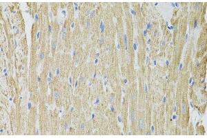 Immunohistochemistry of paraffin-embedded Rat heart using FHIT Polyclonal Antibody at dilution of 1:100 (40x lens). (FHIT 抗体)