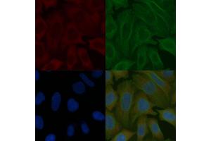PROK1 Mouse Monoclonal Antibody staining Hela cells by IF/ICC. (Prokineticin 1 抗体)