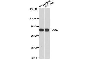 Western blot analysis of extracts of various cell lines, using SOX9 antibody. (SOX9 抗体  (AA 100-200))