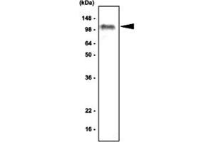 Western blot analysis of human Ramos cell lysate (80 ug) were resolved by SDS - PAGE , transferred to PVDF membrane and probed with TLR7 monoclonal antibody , clone 4F4 (1 : 1000) . (TLR7 抗体  (AA 451-500))