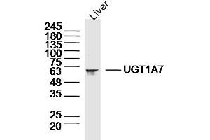UGT1A7 anticorps  (AA 431-531)